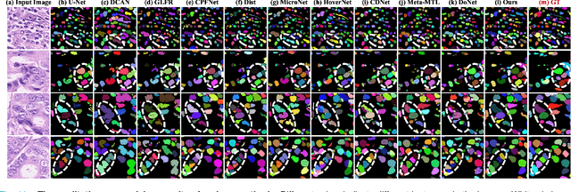 Figure 3 for SEINE: Structure Encoding and Interaction Network for Nuclei Instance Segmentation