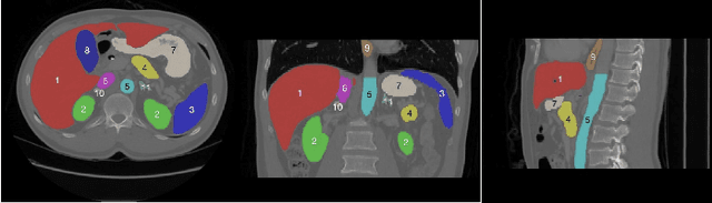 Figure 3 for Towards more precise automatic analysis: a comprehensive survey of deep learning-based multi-organ segmentation