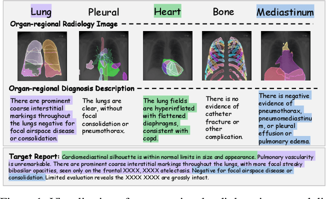 Figure 1 for ORID: Organ-Regional Information Driven Framework for Radiology Report Generation