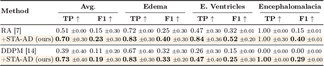 Figure 4 for Selective Test-Time Adaptation for Unsupervised Anomaly Detection using Neural Implicit Representations