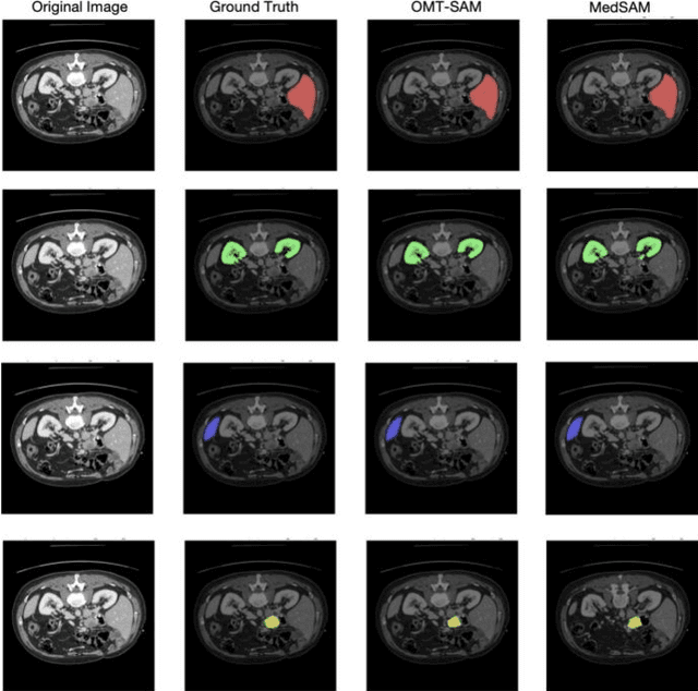 Figure 4 for Organ-aware Multi-scale Medical Image Segmentation Using Text Prompt Engineering