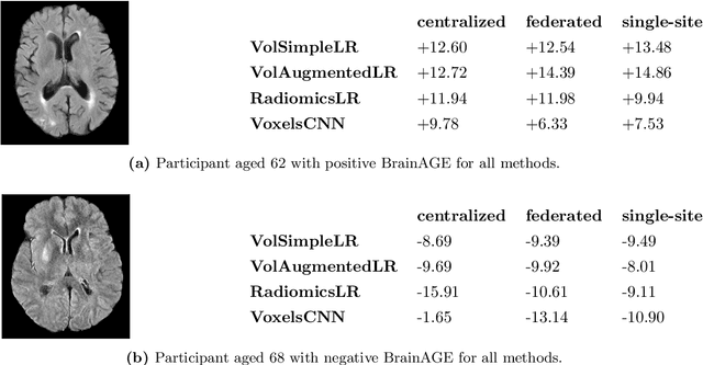 Figure 4 for Federated Learning for MRI-based BrainAGE: a multicenter study on post-stroke functional outcome prediction