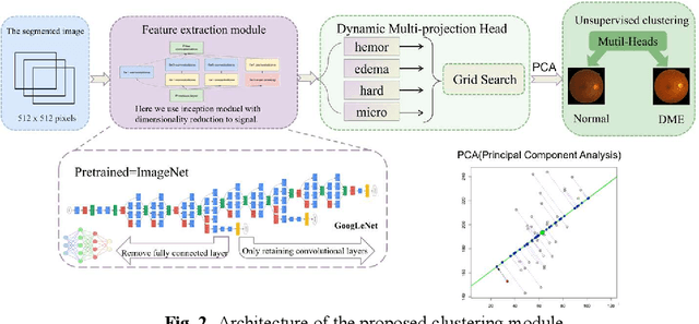 Figure 3 for RURANET++: An Unsupervised Learning Method for Diabetic Macular Edema Based on SCSE Attention Mechanisms and Dynamic Multi-Projection Head Clustering