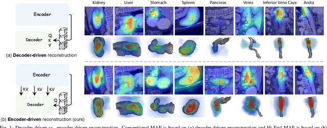 Figure 1 for Hi-End-MAE: Hierarchical encoder-driven masked autoencoders are stronger vision learners for medical image segmentation