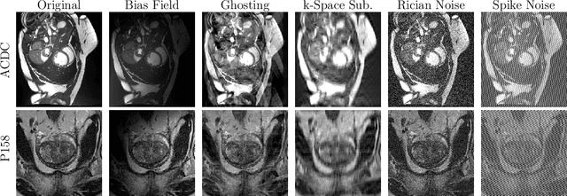 Figure 1 for Data-Agnostic Augmentations for Unknown Variations: Out-of-Distribution Generalisation in MRI Segmentation