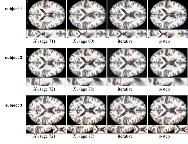 Figure 4 for Time Series Generative Learning with Application to Brain Imaging Analysis