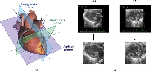 Figure 1 for EigenHearts: Cardiac Diseases Classification Using EigenFaces Approach