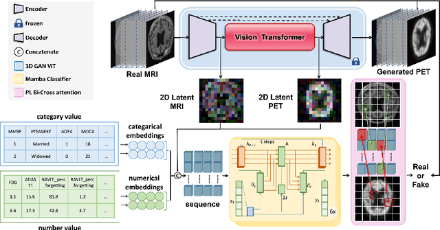 Figure 1 for GFE-Mamba: Mamba-based AD Multi-modal Progression Assessment via Generative Feature Extraction from MCI