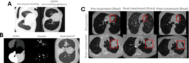 Figure 4 for ImmunoDiff: A Diffusion Model for Immunotherapy Response Prediction in Lung Cancer