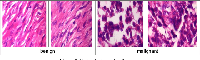 Figure 3 for Analysis of Transferred Pre-Trained Deep Convolution Neural Networks in Breast Masses Recognition