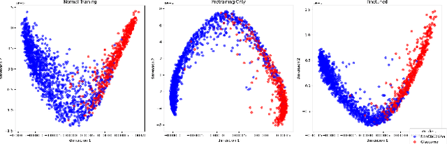 Figure 1 for DiffuPT: Class Imbalance Mitigation for Glaucoma Detection via Diffusion Based Generation and Model Pretraining
