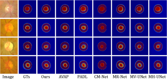 Figure 3 for Transformer-based Annotation Bias-aware Medical Image Segmentation