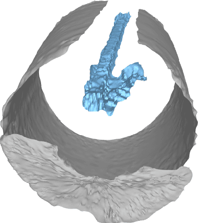 Figure 3 for SMRVIS: Point cloud extraction from 3-D ultrasound for non-destructive testing