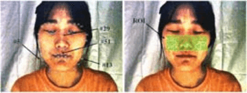 Figure 1 for Image Enhancement for Remote Photoplethysmography in a Low-Light Environment