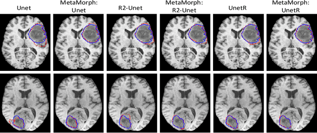 Figure 3 for MetaMorph: Learning Metamorphic Image Transformation With Appearance Changes
