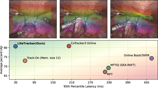 Figure 1 for LiteTracker: Leveraging Temporal Causality for Accurate Low-latency Tissue Tracking