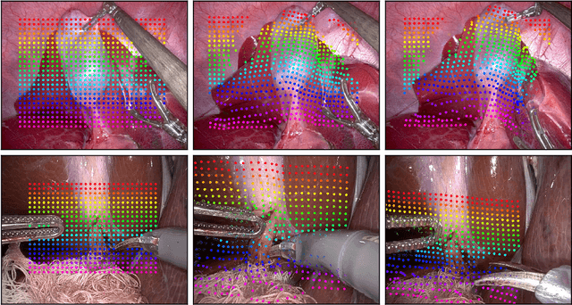 Figure 4 for LiteTracker: Leveraging Temporal Causality for Accurate Low-latency Tissue Tracking
