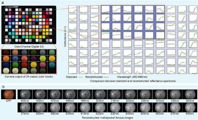 Figure 2 for A graph neural network-based multispectral-view learning model for diabetic macular ischemia detection from color fundus photographs