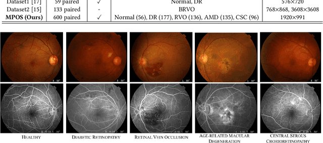 Figure 1 for Non-Invasive to Invasive: Enhancing FFA Synthesis from CFP with a Benchmark Dataset and a Novel Network