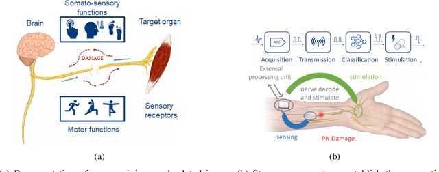 Figure 1 for Artificial Neural Networks-based Real-time Classification of ENG Signals for Implanted Nerve Interfaces