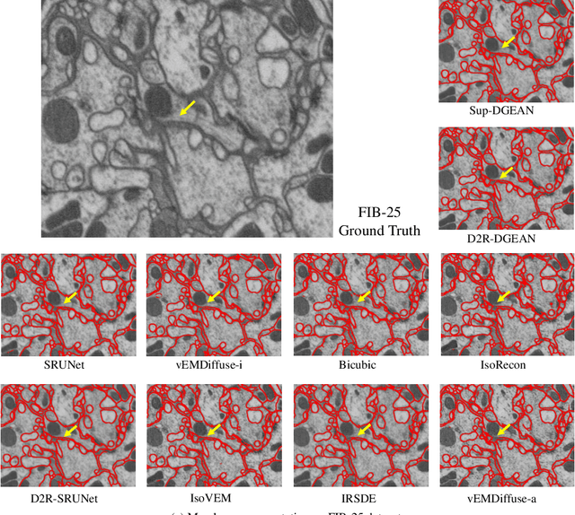 Figure 4 for From Diffusion to Resolution: Leveraging 2D Diffusion Models for 3D Super-Resolution Task