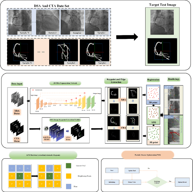 Figure 1 for A Novel Coronary Artery Registration Method Based on Super-pixel Particle Swarm Optimization