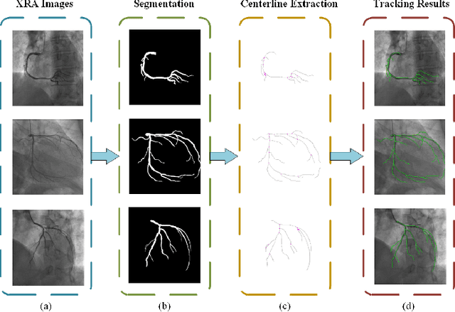 Figure 4 for A Novel Coronary Artery Registration Method Based on Super-pixel Particle Swarm Optimization