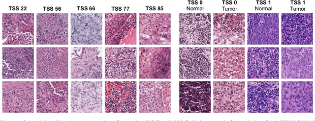 Figure 3 for Do Histopathological Foundation Models Eliminate Batch Effects? A Comparative Study
