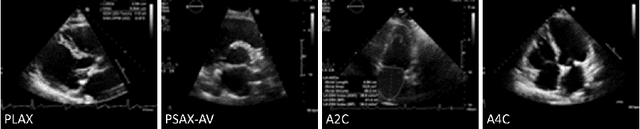 Figure 1 for BackMix: Mitigating Shortcut Learning in Echocardiography with Minimal Supervision