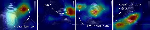 Figure 3 for BackMix: Mitigating Shortcut Learning in Echocardiography with Minimal Supervision