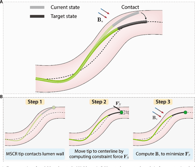 Figure 4 for Real-time simulation enabled navigation control of magnetic soft continuum robots in confined lumens