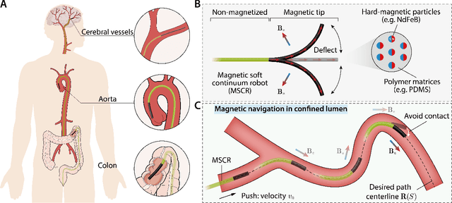 Figure 1 for Real-time simulation enabled navigation control of magnetic soft continuum robots in confined lumens