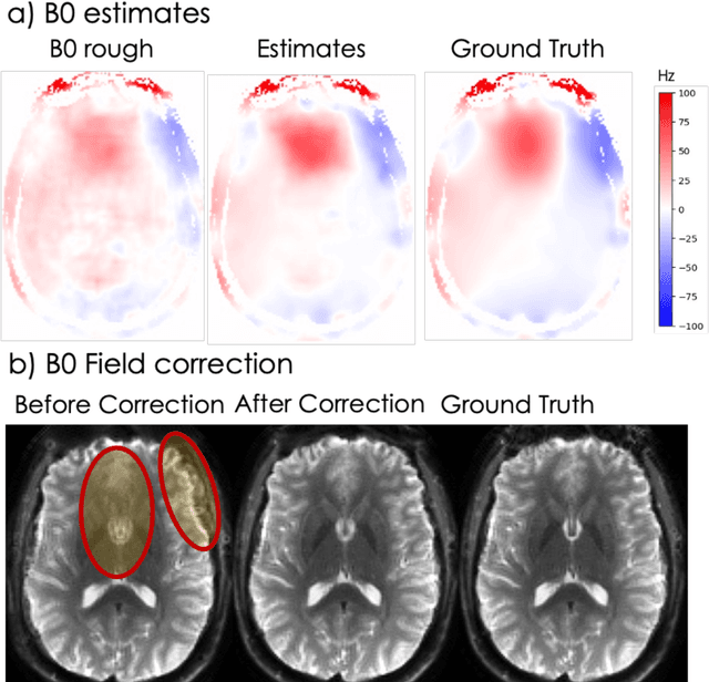 Figure 3 for ACE-Net: AutofoCus-Enhanced Convolutional Network for Field Imperfection Estimation with application to high b-value spiral Diffusion MRI