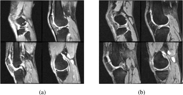 Figure 1 for Improving Generalization in MRI-Based Deep Learning Models for Total Knee Replacement Prediction