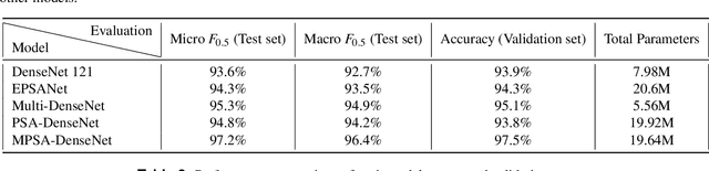 Figure 4 for MPSA-DenseNet: A novel deep learning model for English accent classification