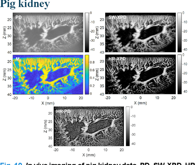 Figure 2 for Contrast-Free Ultrasound Microvascular Imaging via Radiality and Similarity Weighting