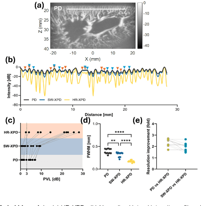 Figure 3 for Contrast-Free Ultrasound Microvascular Imaging via Radiality and Similarity Weighting