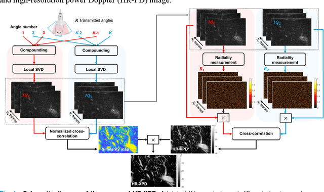 Figure 1 for Contrast-Free Ultrasound Microvascular Imaging via Radiality and Similarity Weighting