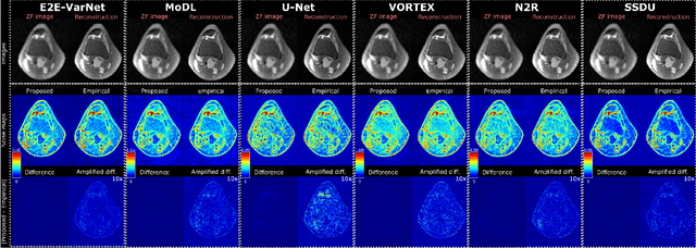 Figure 1 for Efficient Noise Calculation in Deep Learning-based MRI Reconstructions