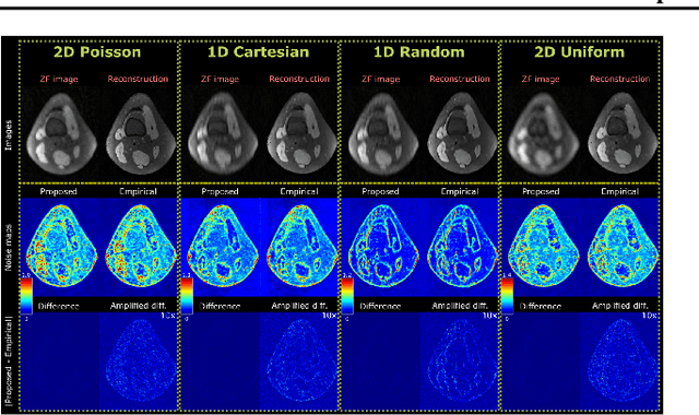 Figure 3 for Efficient Noise Calculation in Deep Learning-based MRI Reconstructions