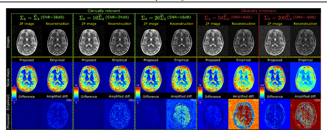 Figure 4 for Efficient Noise Calculation in Deep Learning-based MRI Reconstructions