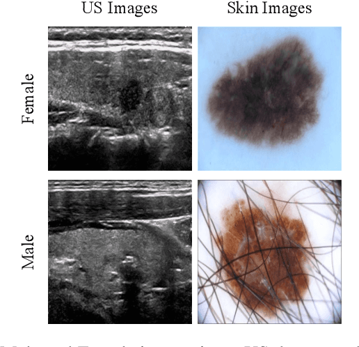 Figure 4 for Inspecting Model Fairness in Ultrasound Segmentation Tasks