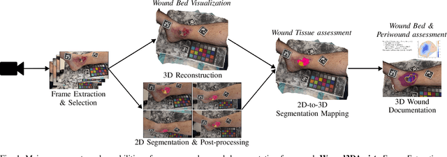 Figure 1 for Wound3DAssist: A Practical Framework for 3D Wound Assessment