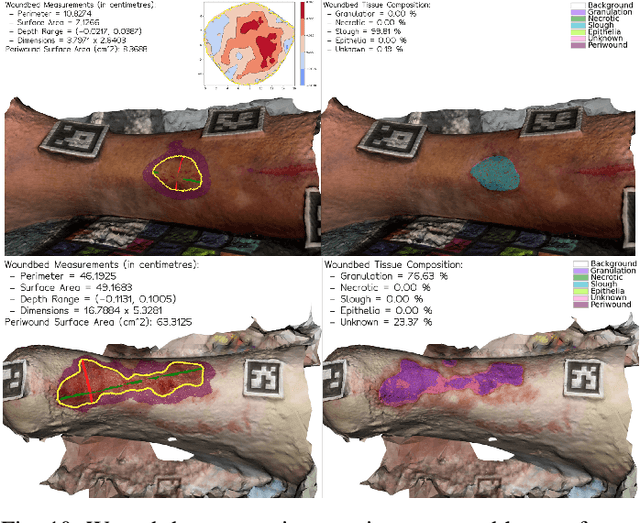 Figure 2 for Wound3DAssist: A Practical Framework for 3D Wound Assessment