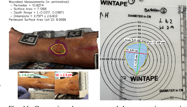Figure 3 for Wound3DAssist: A Practical Framework for 3D Wound Assessment
