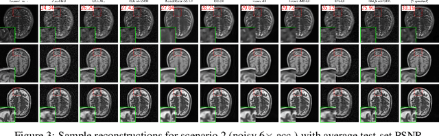 Figure 4 for Benchmarking Self-Supervised Methods for Accelerated MRI Reconstruction