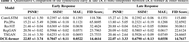 Figure 2 for DCE-FORMER: A Transformer-based Model With Mutual Information And Frequency-based Loss Functions For Early And Late Response Prediction In Prostate DCE-MRI