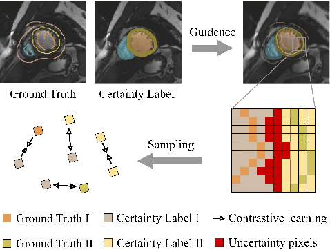 Figure 1 for PCLMix: Weakly Supervised Medical Image Segmentation via Pixel-Level Contrastive Learning and Dynamic Mix Augmentation