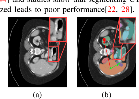 Figure 1 for Advancing Medical Image Segmentation: Morphology-Driven Learning with Diffusion Transformer