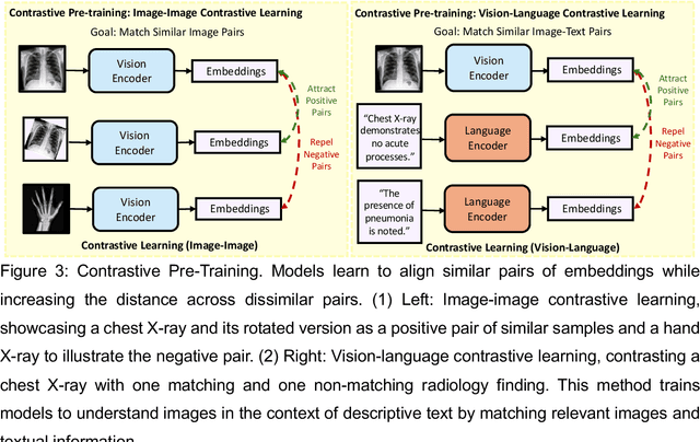 Figure 3 for Foundation Models in Radiology: What, How, When, Why and Why Not